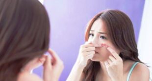 Tips Mengurangi Pertumbuhan Jerawat dengan Mengatur Pola Makan